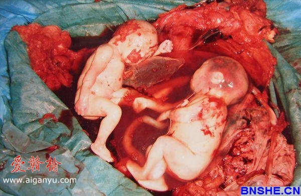 连云港圣安医院(赣榆)不甚安