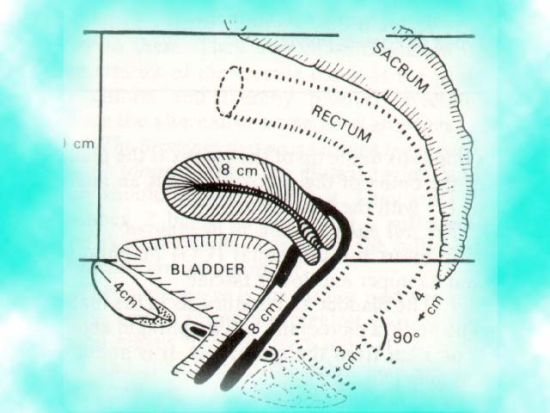 探秘人体性快感带：直肠里的四个G点(多图)