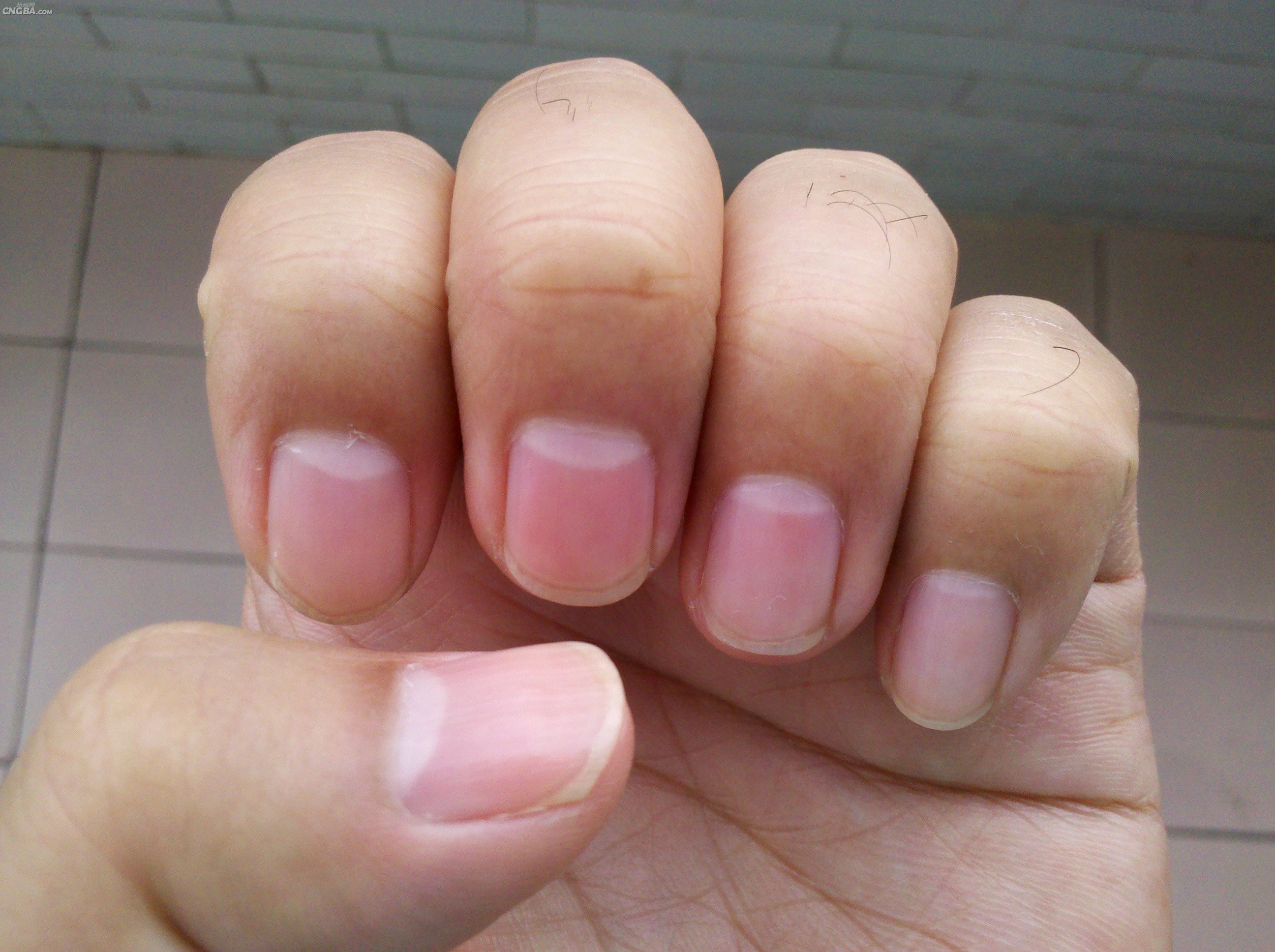 指甲“月牙”是健康晴雨表！无半月痕可能性冷淡？