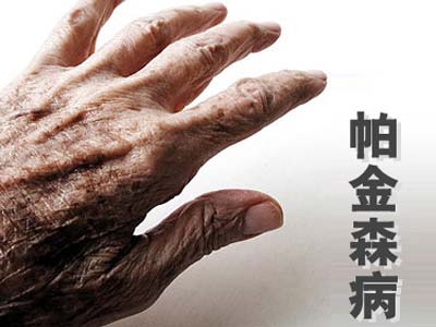 医生提示帕金森四个症状可提早发现