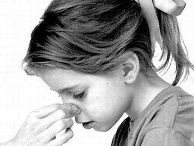 上火并不是鼻子出血唯一原因